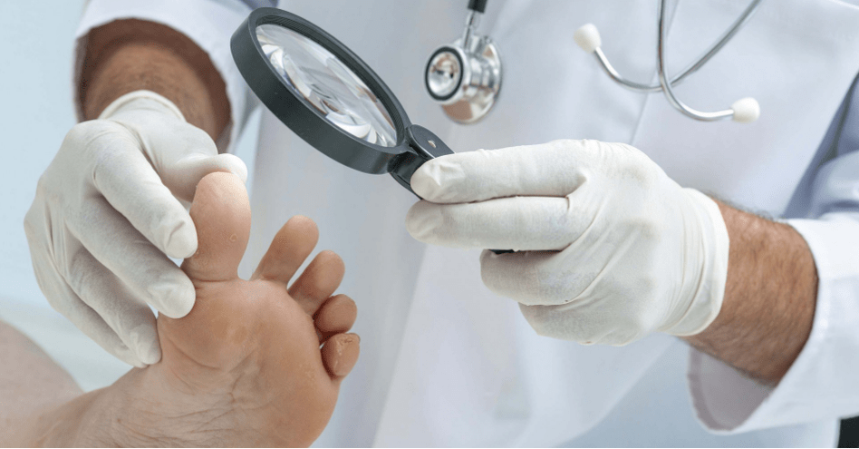 The first symptoms of the mushroom on the legs