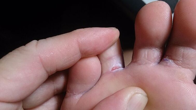 foot mushroom