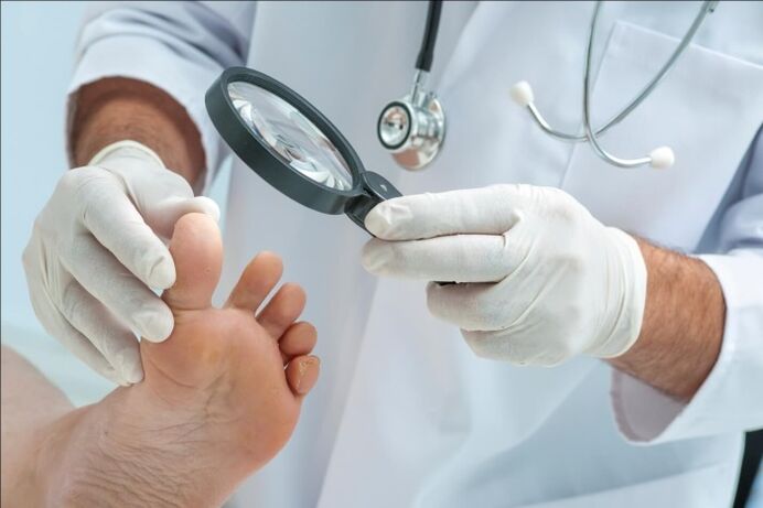 Before prescribing a treatment for toenail fungus, your doctor will conduct an examination